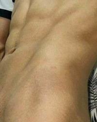 Foto 3 de 10