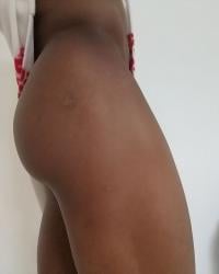 Foto 8 de 16