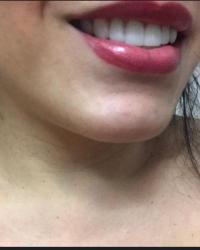 Foto 17 de 36