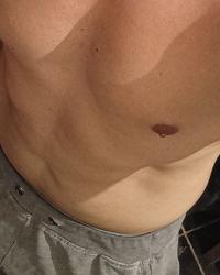 Foto 3 de 3
