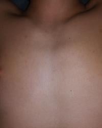 Foto 39 de 59