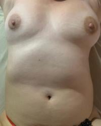 Foto 10 de 23