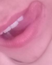 Foto 10 de 16